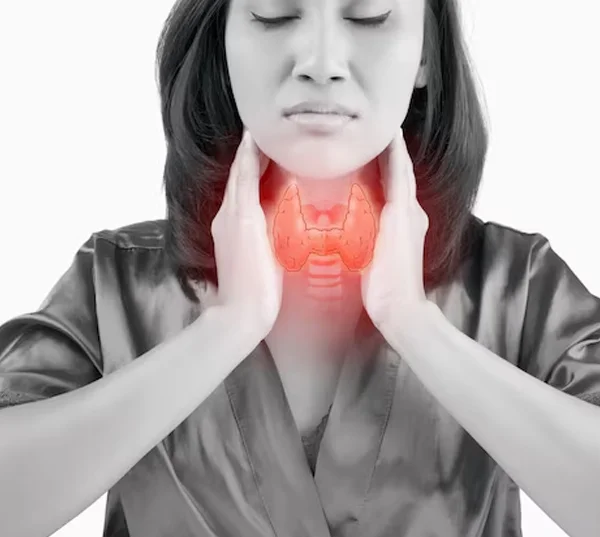 Thyroid Related Female Issues