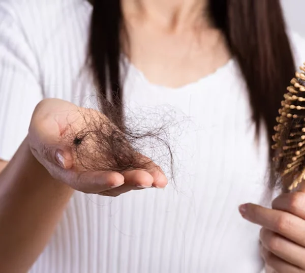 Hairfall