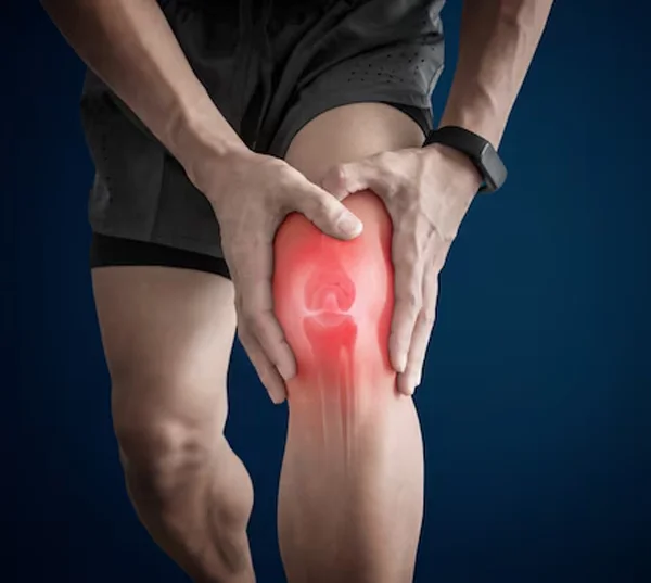 Arthritis And Joint Diseases